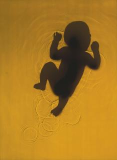 Adam Fuss - Journey (Yellow Baby)