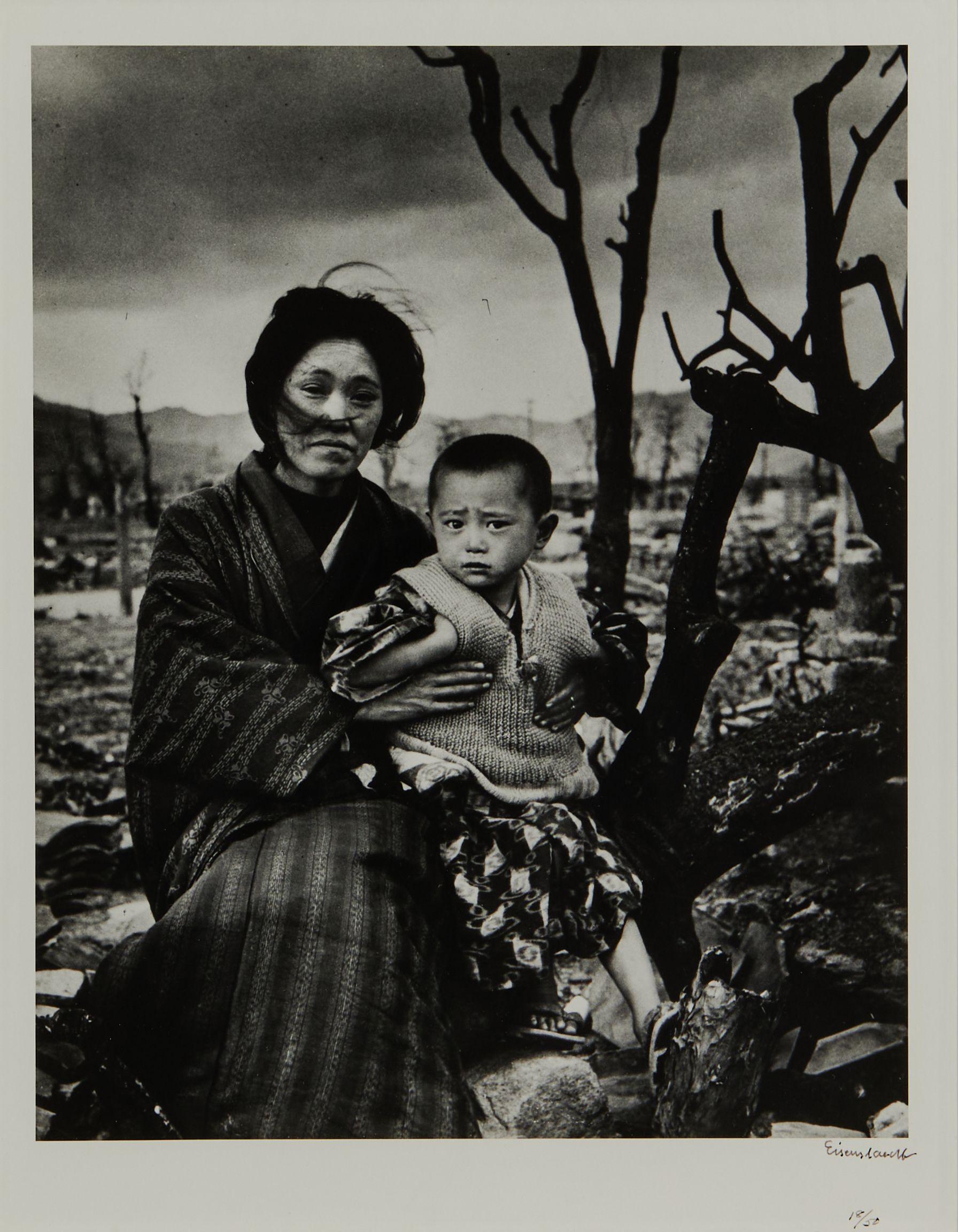 Alfred Eisenstaedt - Mother and Child Four Months After the Atomic Bomb, Hiroshima