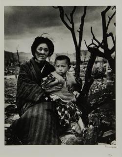 Alfred Eisenstaedt - Mother and Child Four Months After the Atomic Bomb, Hiroshima
