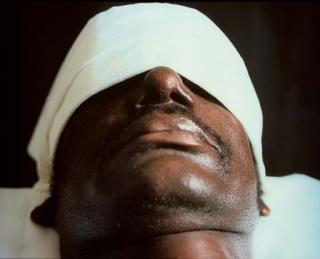 Andres Serrano - The Morgue (Pneumonia Death)