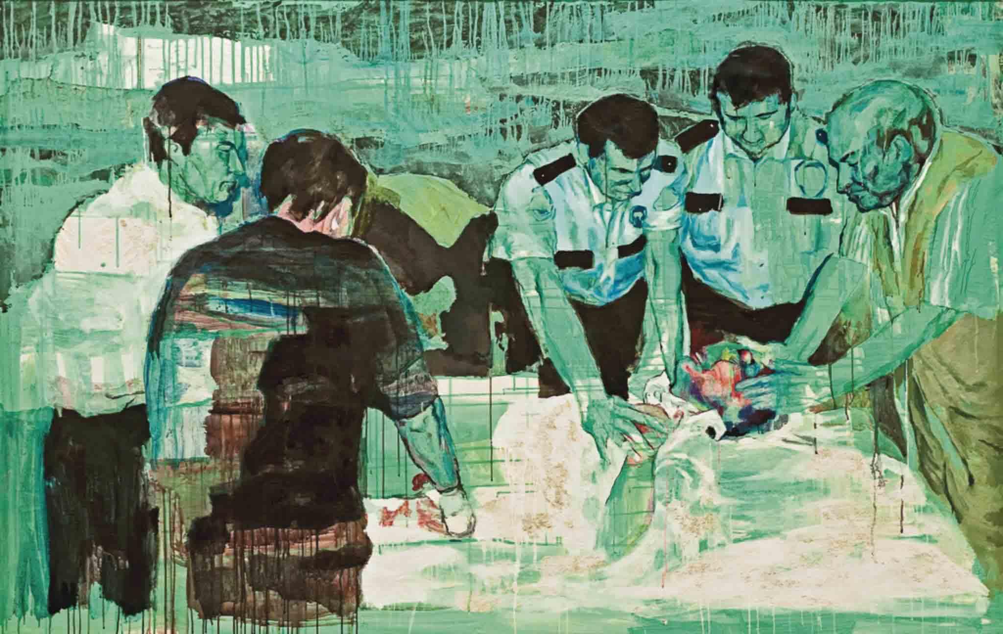 Asli Torcu - Circumcision