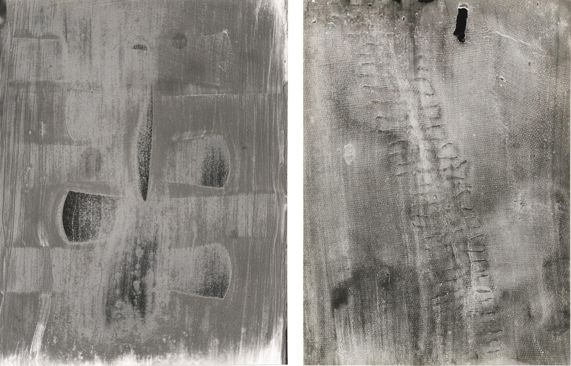 Běla Kolářová - Czech scalpel And Darning