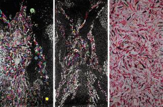 Bharti Kher - Itch, Scratch, Raw