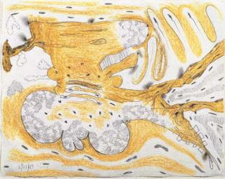 Carroll Dunham - Untitled (6/23/89)