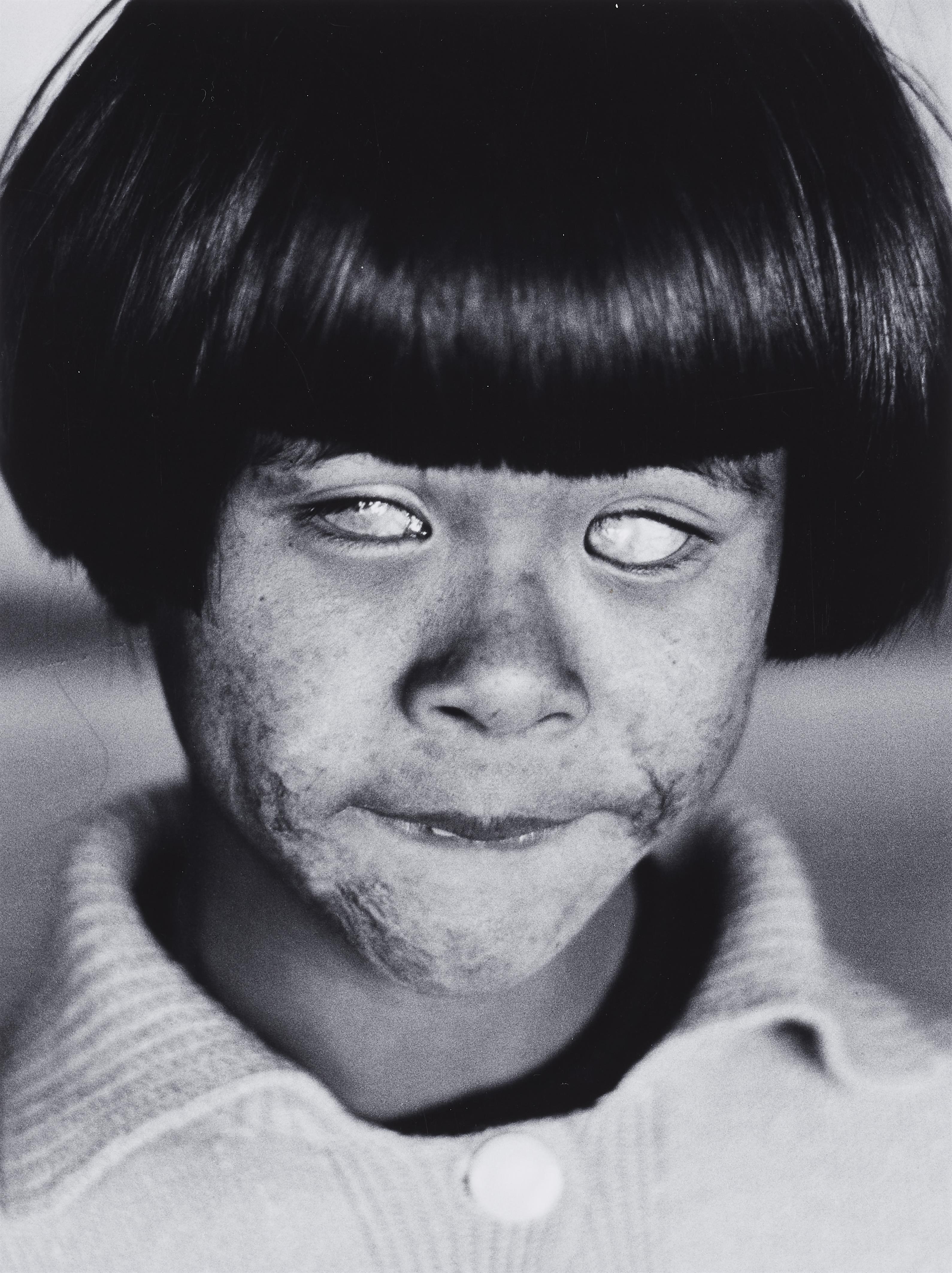 Christer Strömholm - The blind Girl, Hiroshima