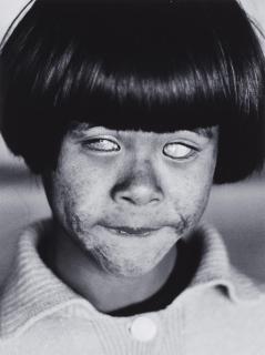Christer Strömholm - The blind Girl, Hiroshima