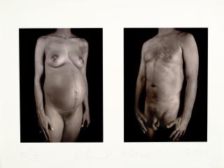 Chuck Close - Untitled, from Doctors of the World portfolio
