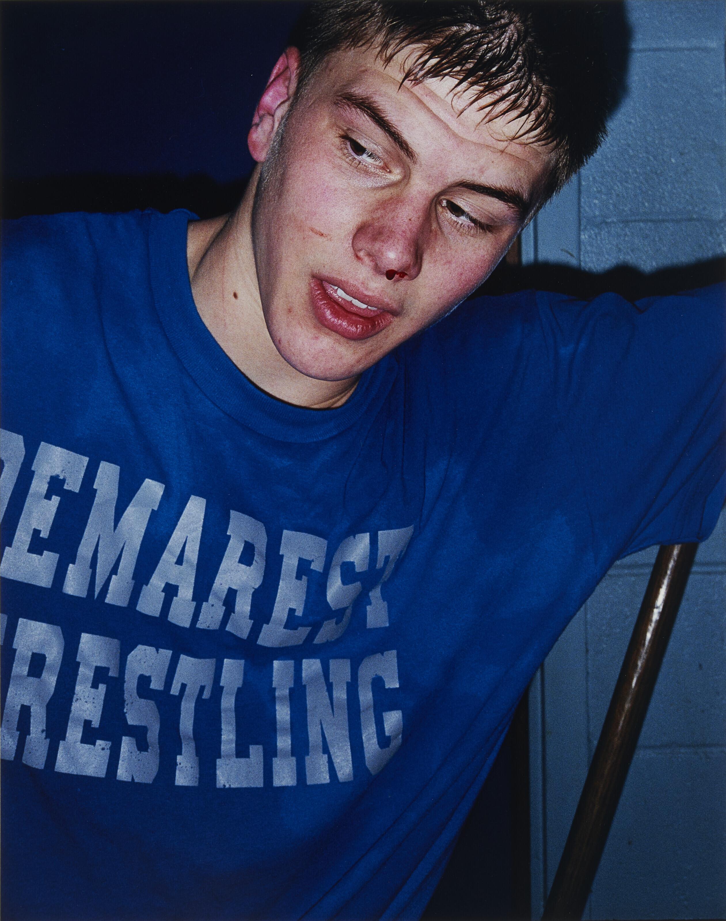 Collier Schorr - Bloody Nose, 1999