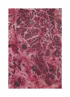 Damien Hirst - M220/140 Skin Mole, LM_SPL.jpg