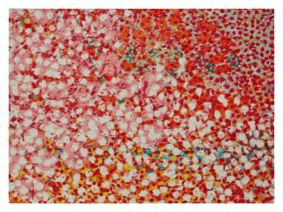 Damien Hirst - Sans Souci