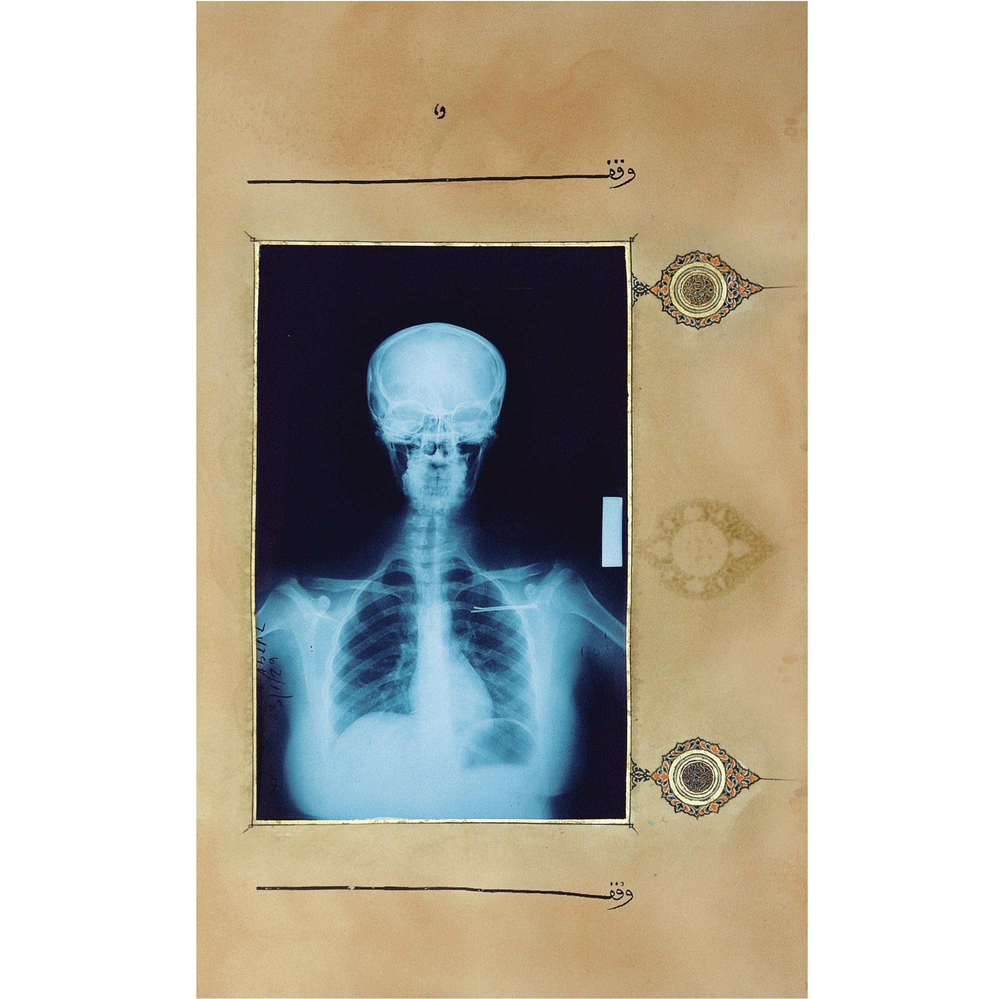 Dr. Ahmed Mater - Illumination (Head On)