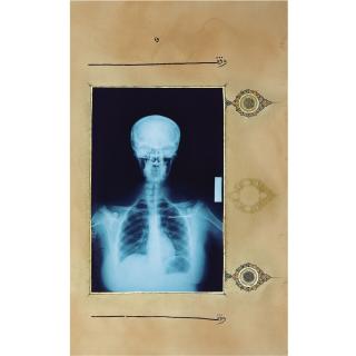 Dr. Ahmed Mater - Illumination (Head On)