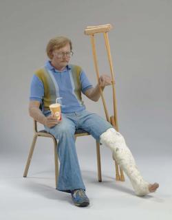 Duane Hanson - Man With Crutch