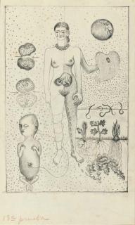 Frida Kahlo - Frida and the Miscarriage