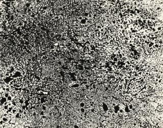 Jean Dubuffet - Paysage