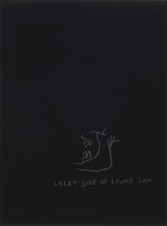 Jean-Michel Basquiat - Left side of lower Jaw, from Anatomy