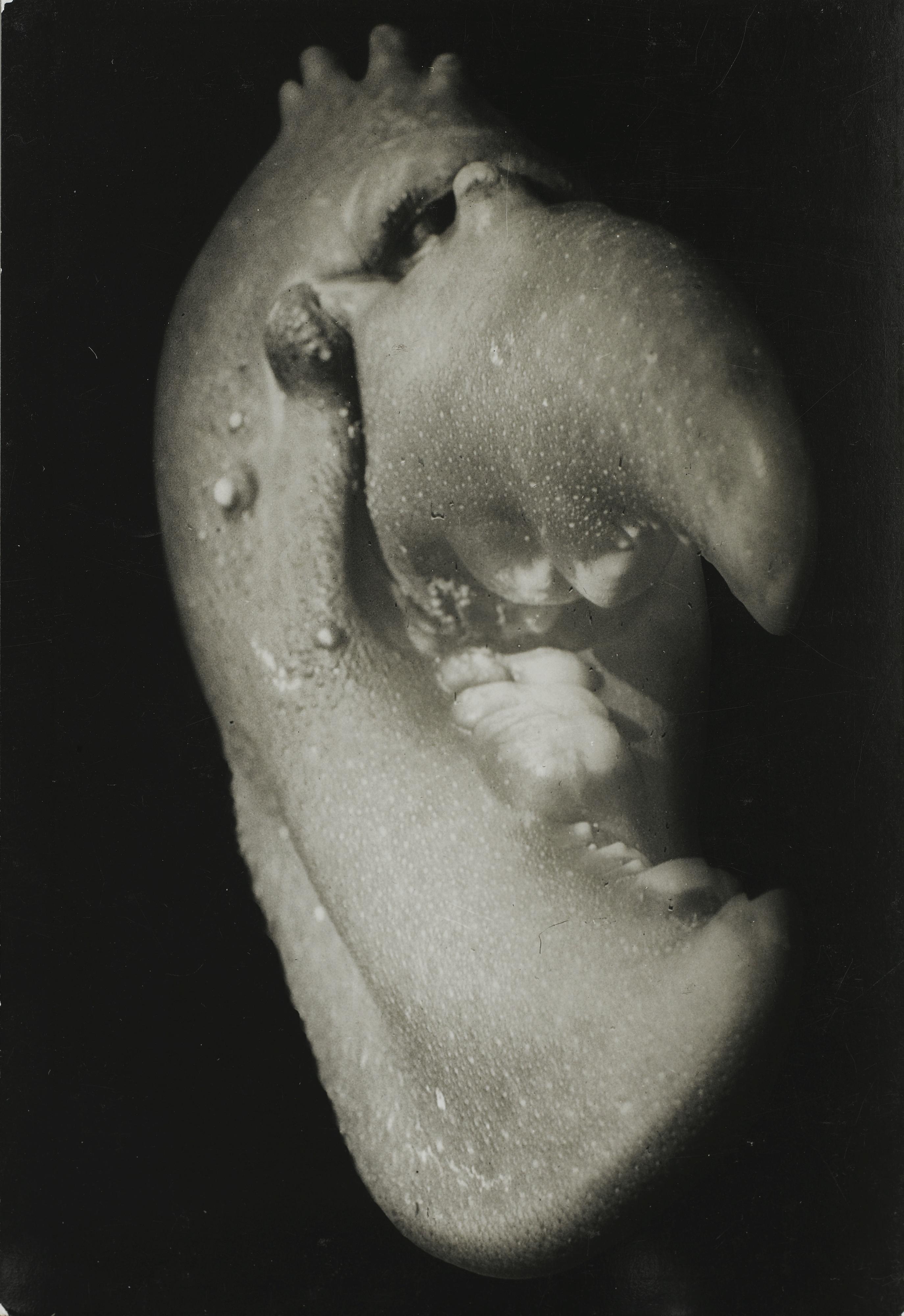 Jean Painlevé - Pince De Homard, 1929Vintage Silver Print On Post-Card. On The Reverse, Signed By Jean Painlevé And Stamped \'Foto Lotar\'.