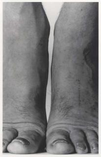 John Coplans - Selfportrait Feet, Frontal; Selfportrait Back With Hands Above