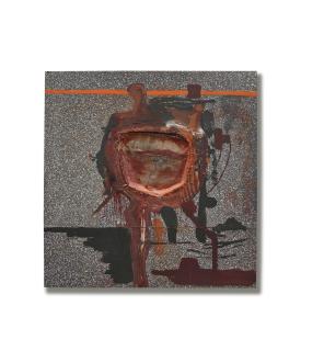 Julian Schnabel - Avoiding Open Heart Surgery