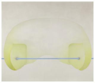 Lambert Maria Wintersberger - Doppelverletzung