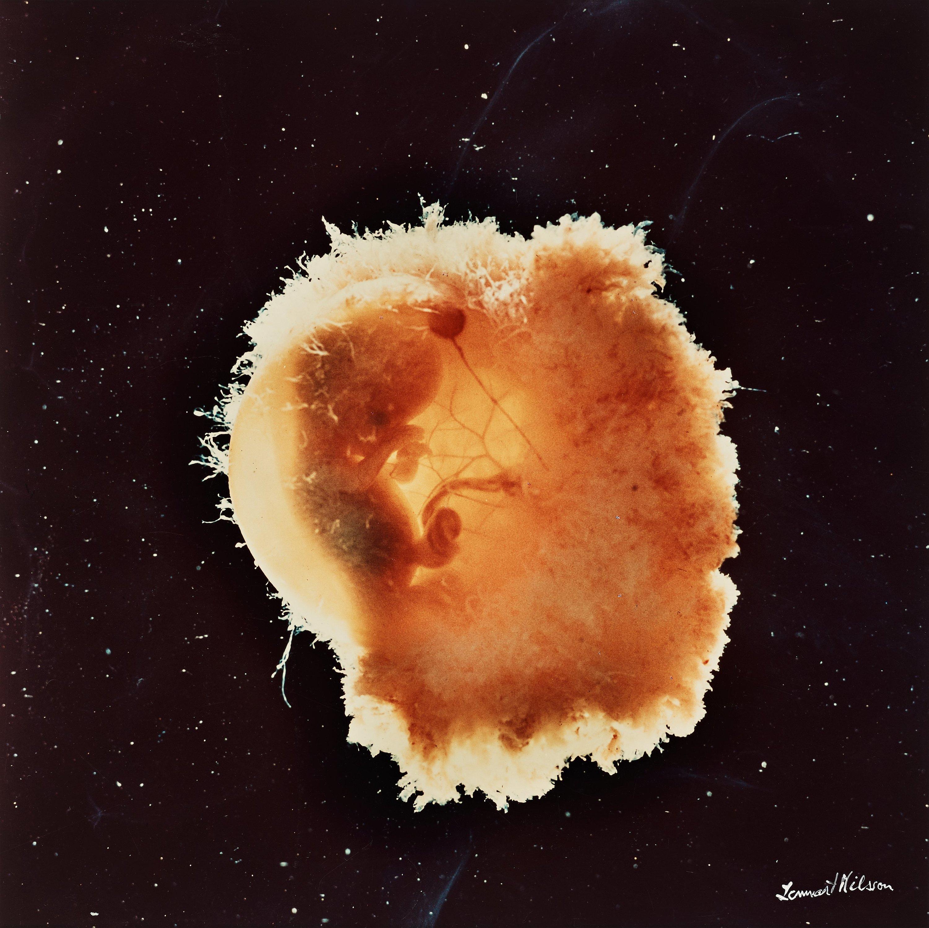 Lennart Nilsson - From \