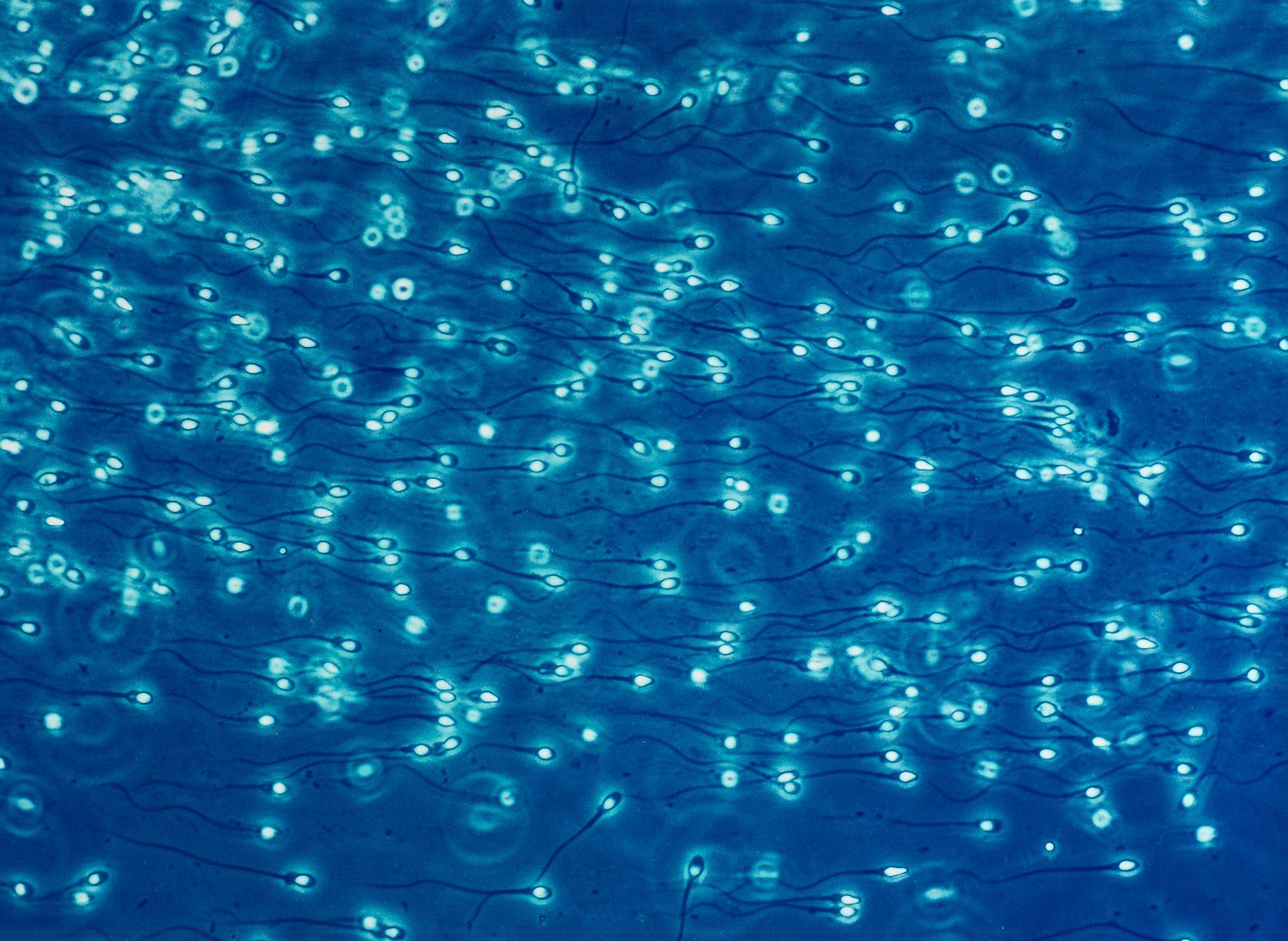 Lennart Nilsson - Untitled, from A child is born