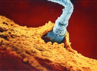 Lennart Nilsson - Untitled