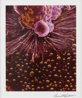 Lennart Nilsson - Utan titel