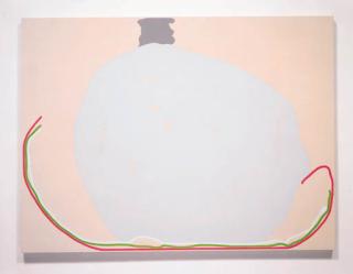 Monique Prieto - Clubfoot