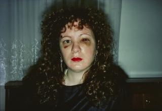 Nan Goldin - Nan after being battered, 1984