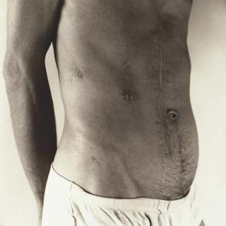 Peter Hujar - Pascal-Scars, 1980