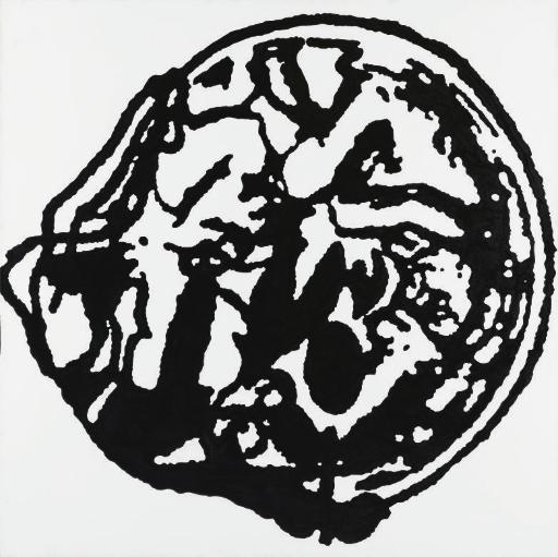 Peter Nagy - Sign of Malignancy