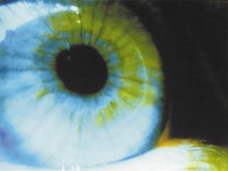 Pipilotti Rist - CLN - 47 11