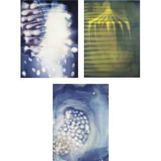 Ross Bleckner - Three Works I) Not Being Born Ii) Untitled Iii) Untitled
