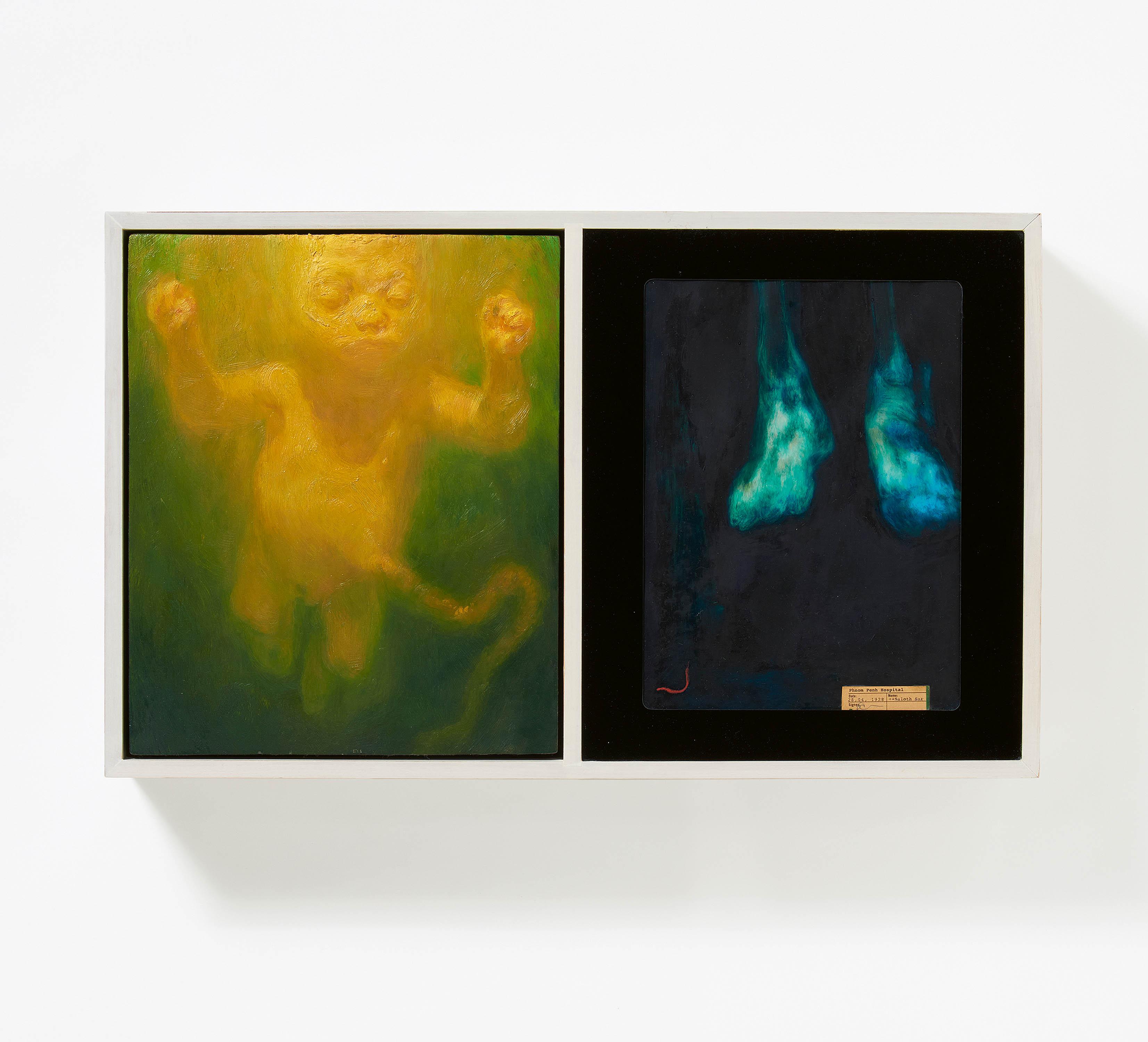 Ruprecht von Kaufmann - Saloth Sar/Baby