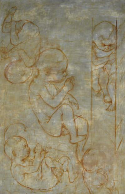 Stephen Greene - Infant