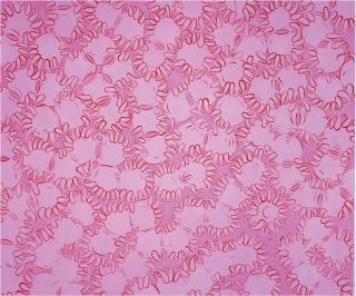 Sue Williams - Patties On Pink