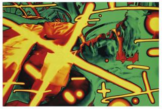 T. V. Santhosh - A Survivor\'S Testimony