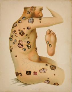 Vagrich Bakhchanyan - Man and Woman (two works)