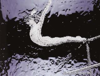 Vik Muniz - Nadia Comaneci (Pictures of Ink)