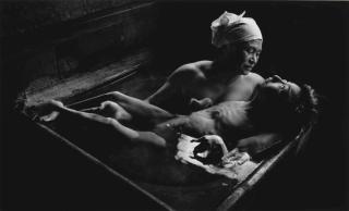 W. Eugene Smith - Tomoko in Her Bath, Minamata, Japan, 1972