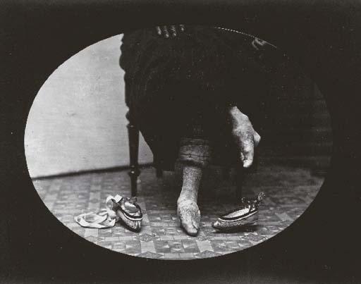 William Saunders - Bound feet