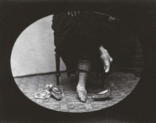 William Saunders - Bound feet