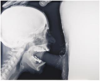 Wim Delvoye - Blow 2