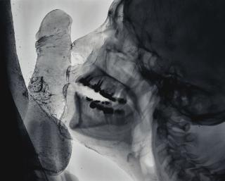 Wim Delvoye - Kiss 2