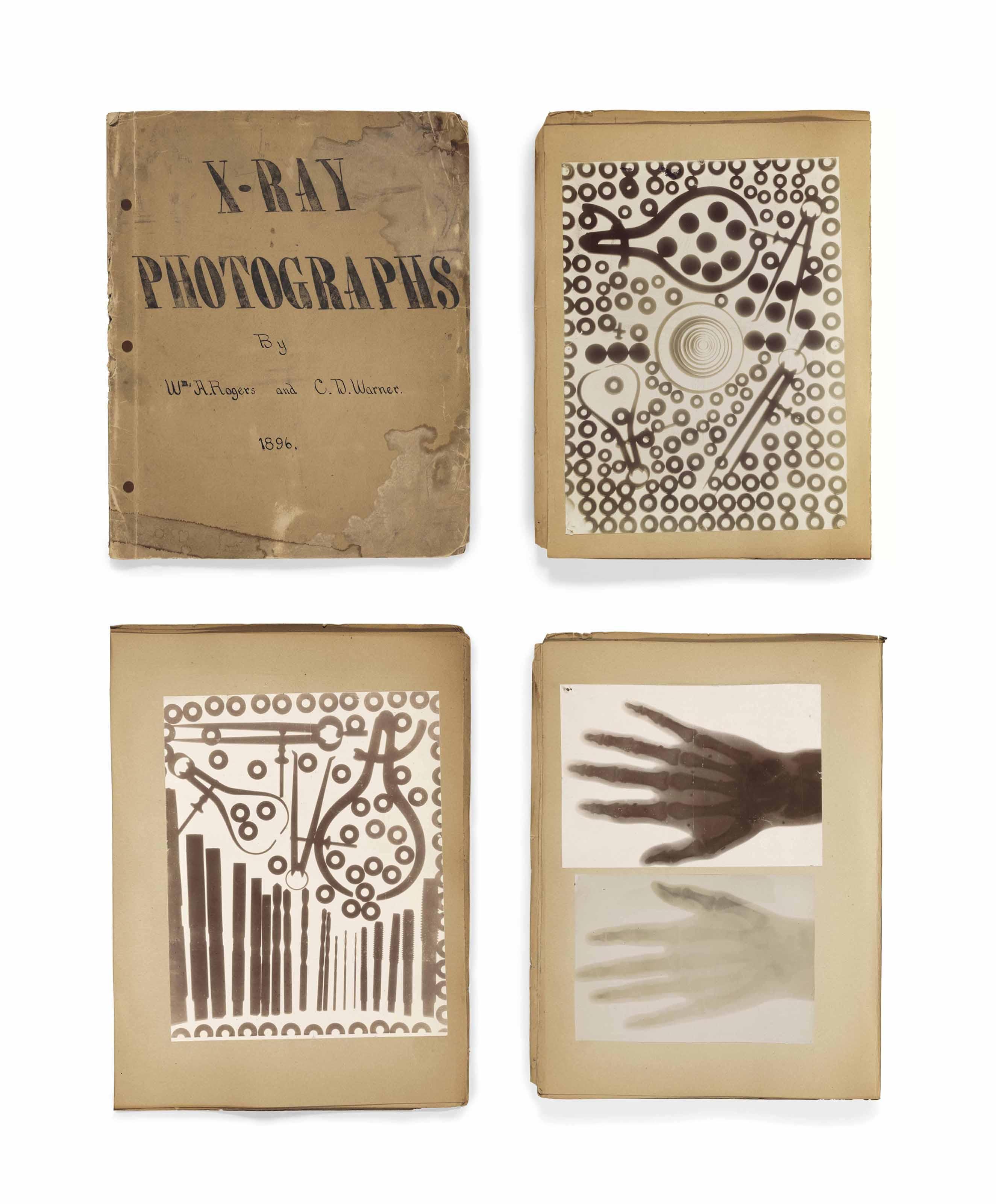 \'X-Ray Photographs\', 1896