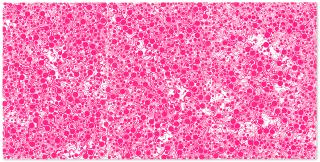 Yayoi Kusama - Flame