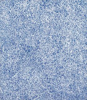 Yayoi Kusama - Raining No.2(Painted in 1988)