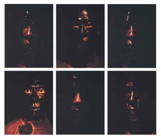 Zhang Huan - Chicken Pox